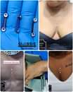 A picture of 1PC 14g Surface Piercing Bar Dermal Anchor Surgical Steel Jewelry