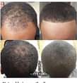 A picture of Hair growth oil