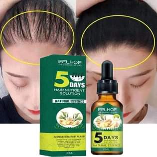 A picture of Jigger hair growth 15 000 ssp only