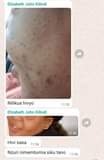 A picture of SCRUB KIBOKO YA SHIDA ZOTE ZA NGOZI