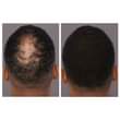 A picture of Hair Growth Oil N Shampoo