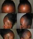 A picture of Hair Growth oil