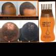 A picture of Hair Growth Oil And Shampoo