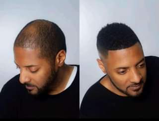 beard oil