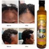 A picture of NATURE HAIR GROWTH OIL