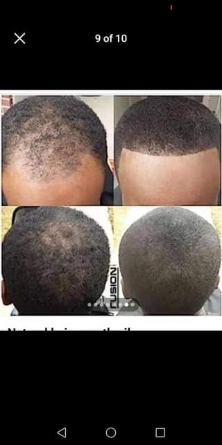 A picture of BEARD AND HAIR GROWTH OIL