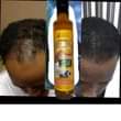 A picture of NATURE HAIR GROWTH OIL