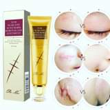 A picture of TCM scar remover