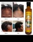 A picture of Natural hair Grow oil