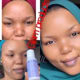 A picture of these in just 4days Facial a
