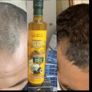 A picture of Original hair grow oil