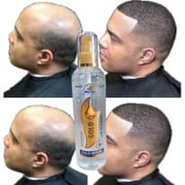 A picture of GOLD AND CHARCOAL HAIR GROWTH SERUM ORIGINAL HAIR GROWTH IN