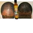 A picture of NATURE HAIR GROWTH OIL