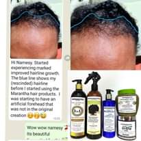 A picture of Grow your hair Long thick healthy strong