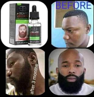 beard products