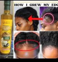 A picture of Original hair growth oil