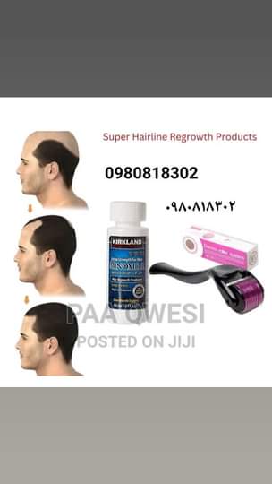 A picture of Minoxidil hair grow