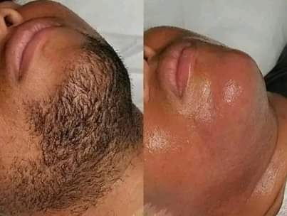 A picture of Inaondoa nywele zozote kwa dk5 tu