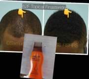 A picture of Hair Growth Oil And Shampoo