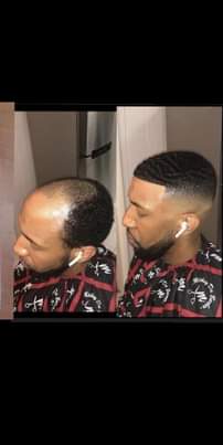 A picture of Neo hair grow