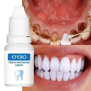 A picture of Teeth whitening liquid