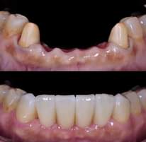 A picture of Meno bandia imara .0717424517