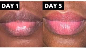 A picture of 7 days Pink lips balm