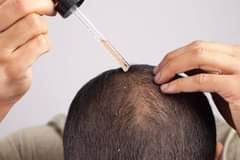 A picture of HAIR GROWTH