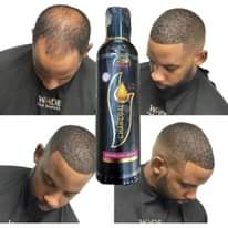 A picture of GOLD AND CHARCOAL HAIR GROWTH SERUM ORIGINAL HAIR GROWTH IN