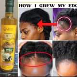 A picture of Hair growth oil