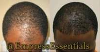 A picture of Hair Growth Oil N Shampoo