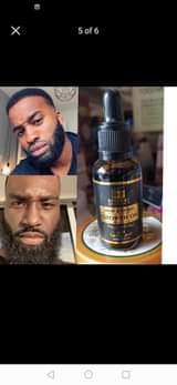 A picture of Hair growth pomade