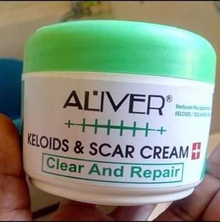 A picture of Keloids and scar cream
