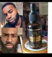 A picture of BEARD GROW OIL 35