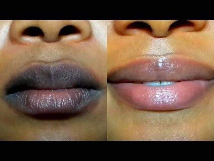 A picture of 7 days Pink lips balm