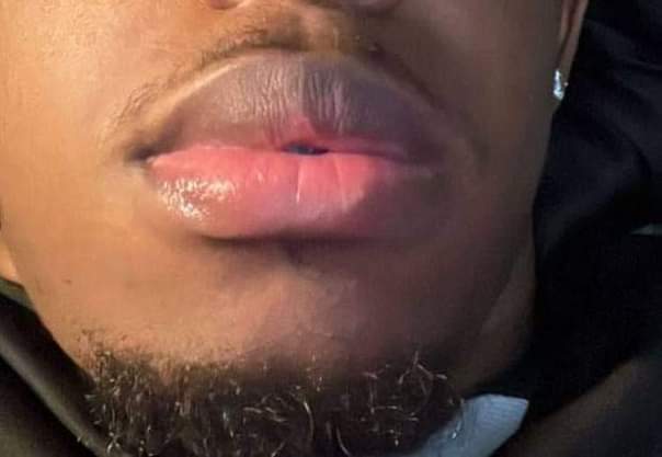 A picture of 7 days Pink lips balm