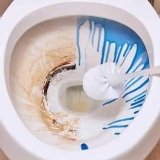 A picture of Kwa usaf wa majumbani atakama sink lako lina uchafu sugu
