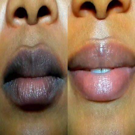 A picture of 7 day Pink lips balm