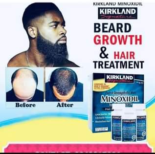 A picture of Original Minoxidil