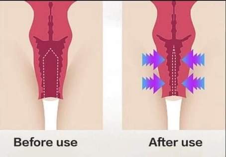 A picture of Tightening gel and wand