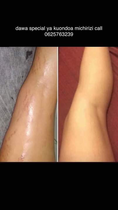 A picture of WHITENING CREAM