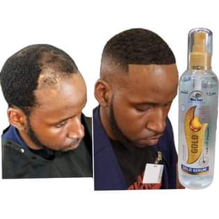 A picture of GOLD AND CHARCOAL HAIR GROWTH SERUM ORIGINAL HAIR GROWTH IN