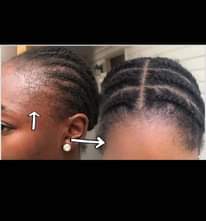 A picture of Jigger hair growth 15 000 ssp only