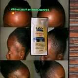 A picture of Monoxidil Hair Growth Spray