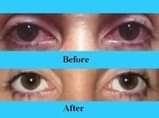 A picture of WHITE EYES
