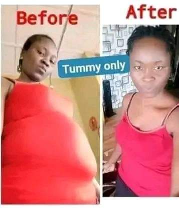 A picture of Weight or tummy loss products