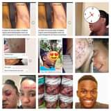 A picture of SCRUB KIBOKO YA SHIDA ZOTE ZA NGOZI