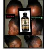 A picture of Hair Growth oil