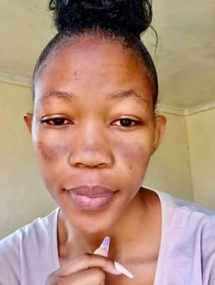 Rustenburg's Q.