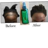 A picture of Anti Hair Loss BALD HEAD REGROWTH OIL SPRAY HAIR LINES